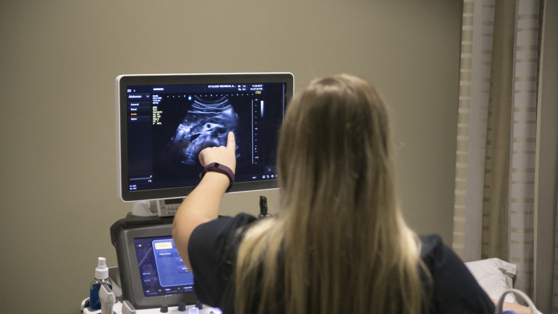 Sonography student pointing at sonogram screen
