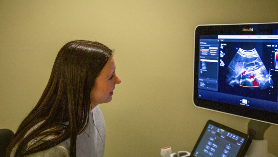 sonography student looking at scan on screen
