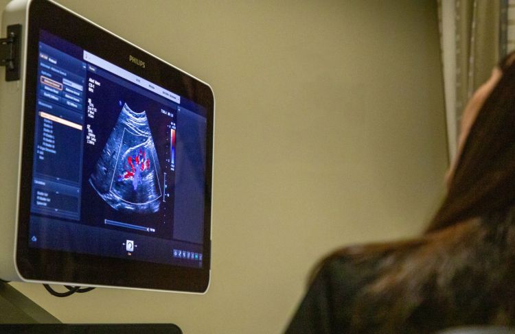 sonographer looking at vein image on machine
